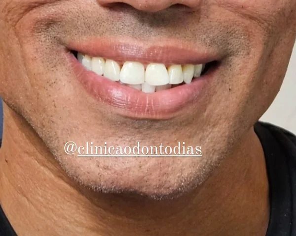 Sorriso de paciente da clínica depois do tratamento estético